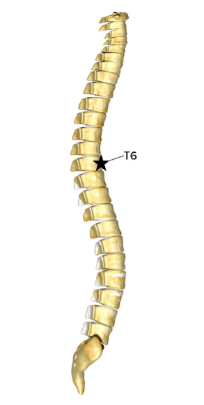 An image of a human spinal cord demonstrating the location of the T6 vertebra
